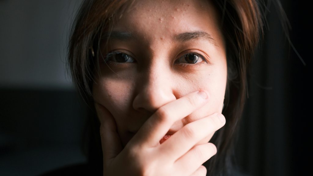 Fungal Acne on Forehead