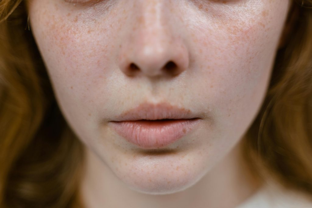 what is oily skin